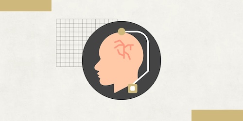 Adaptive Deep Brain Stimulation