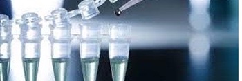 PCR