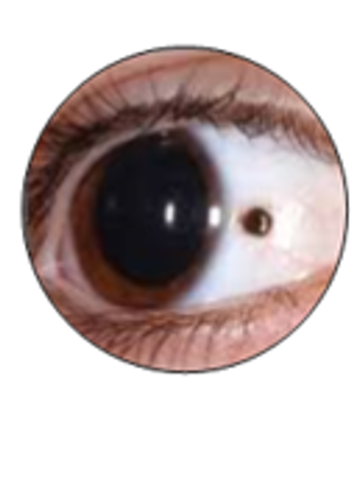 UM 2