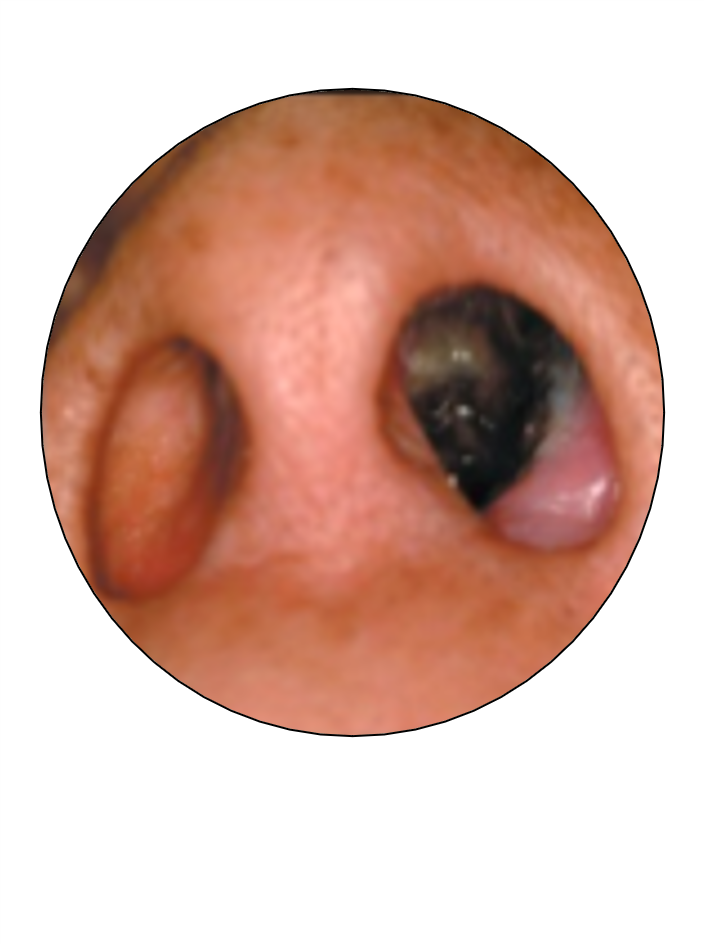 NMM3
