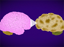 two brains. one pink, one brown