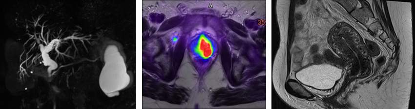 Abdominal imaging filmstrip
