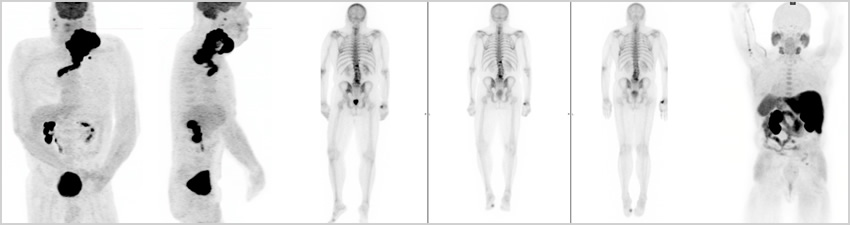 nuclear-medicine-pink-scan