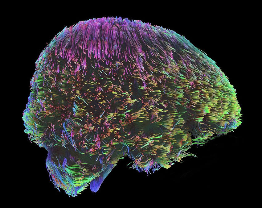 neuro-1