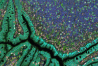 Cancer Biology