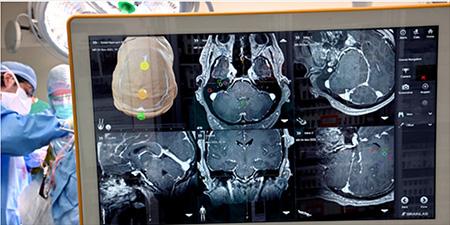 brain imaging in surgery