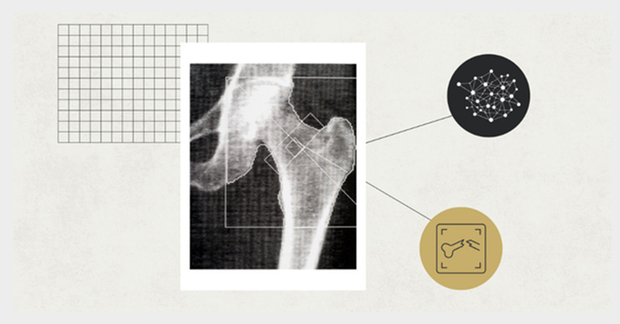 xray bone