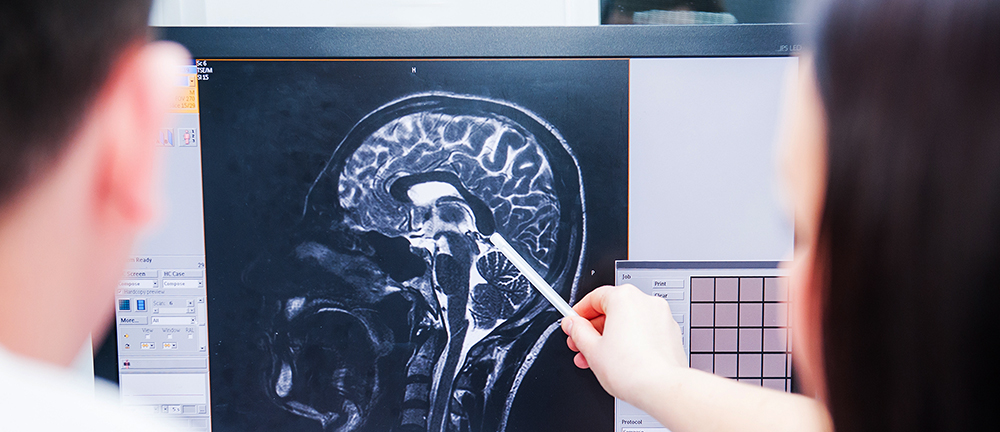 Two students looking at a brain image. One is pointing at the image.