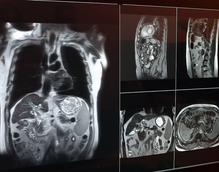 radiation images