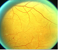 Figure1