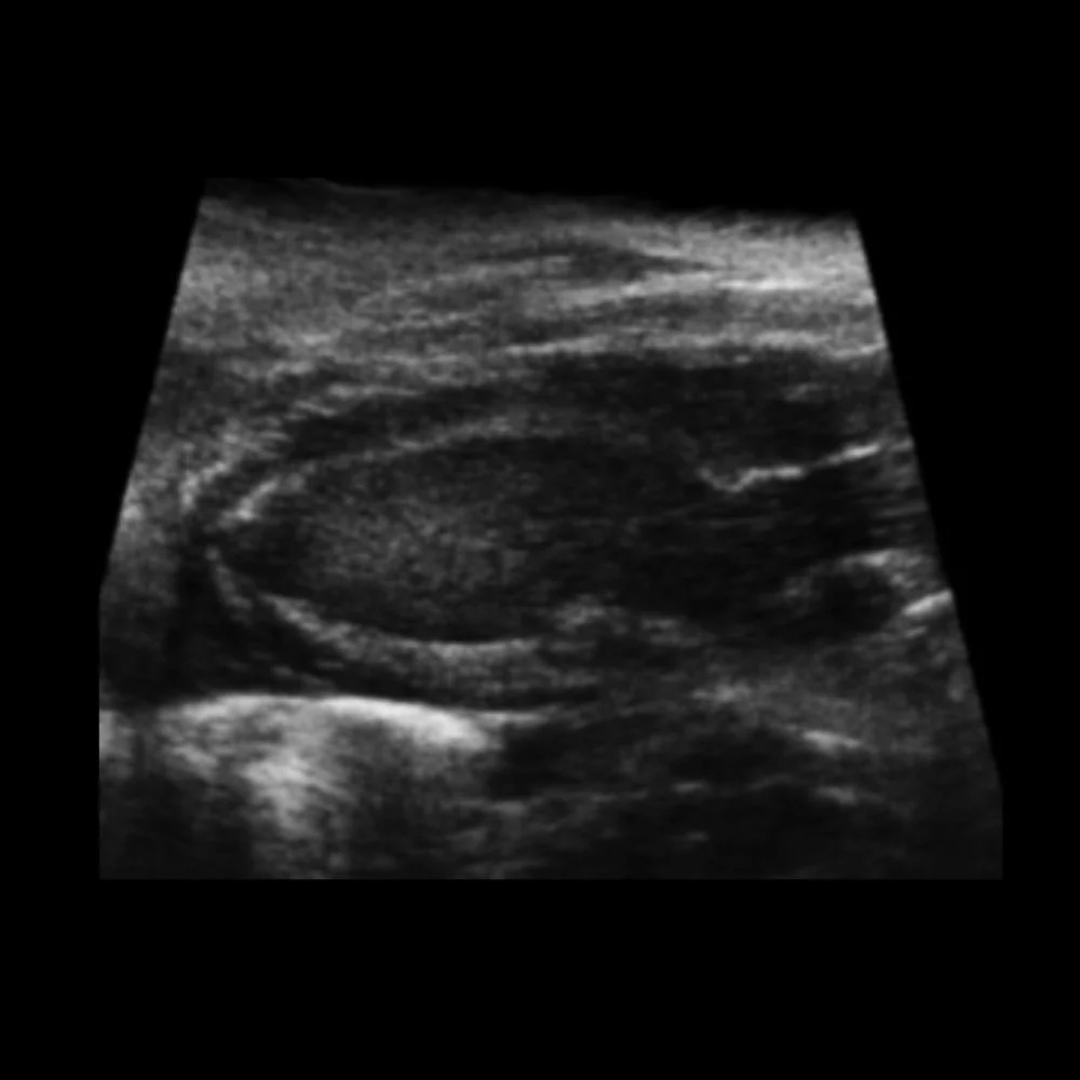 Ultrasound view