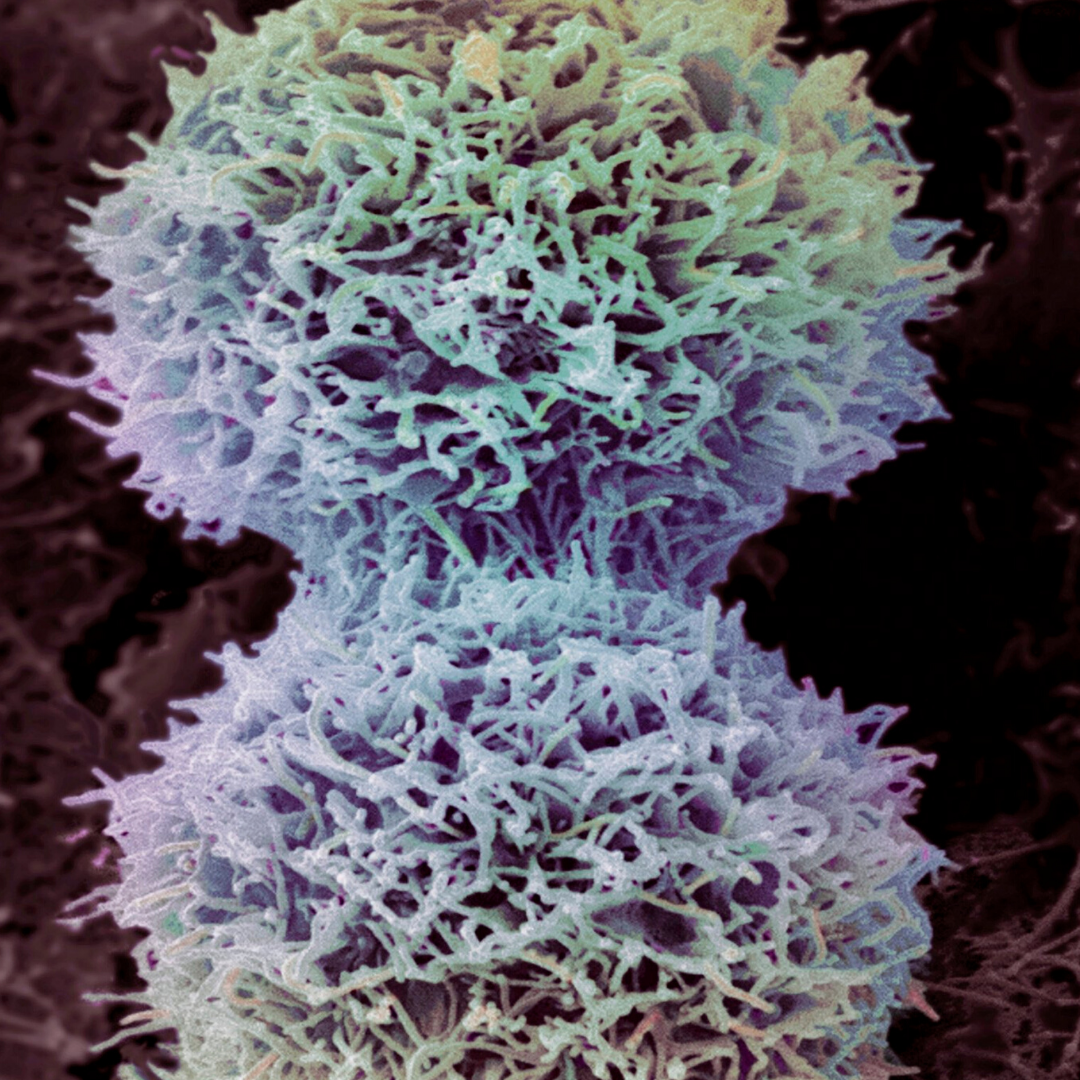 microscopic view of cancer cell