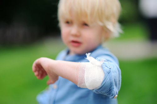 Epidermolysis Bullosa
