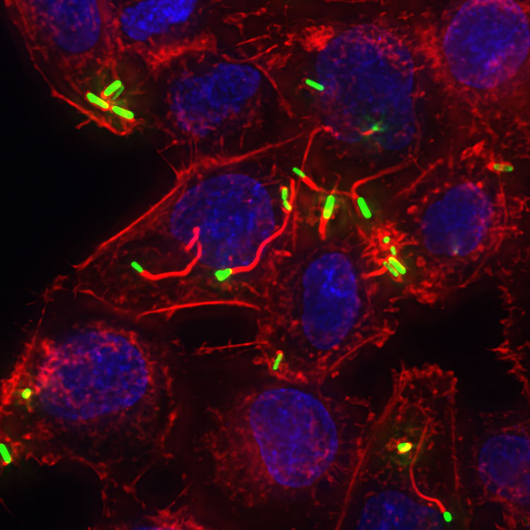 S. flexneri form actin tails