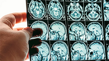 neuro onc 350