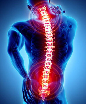 spine-300 spine-300