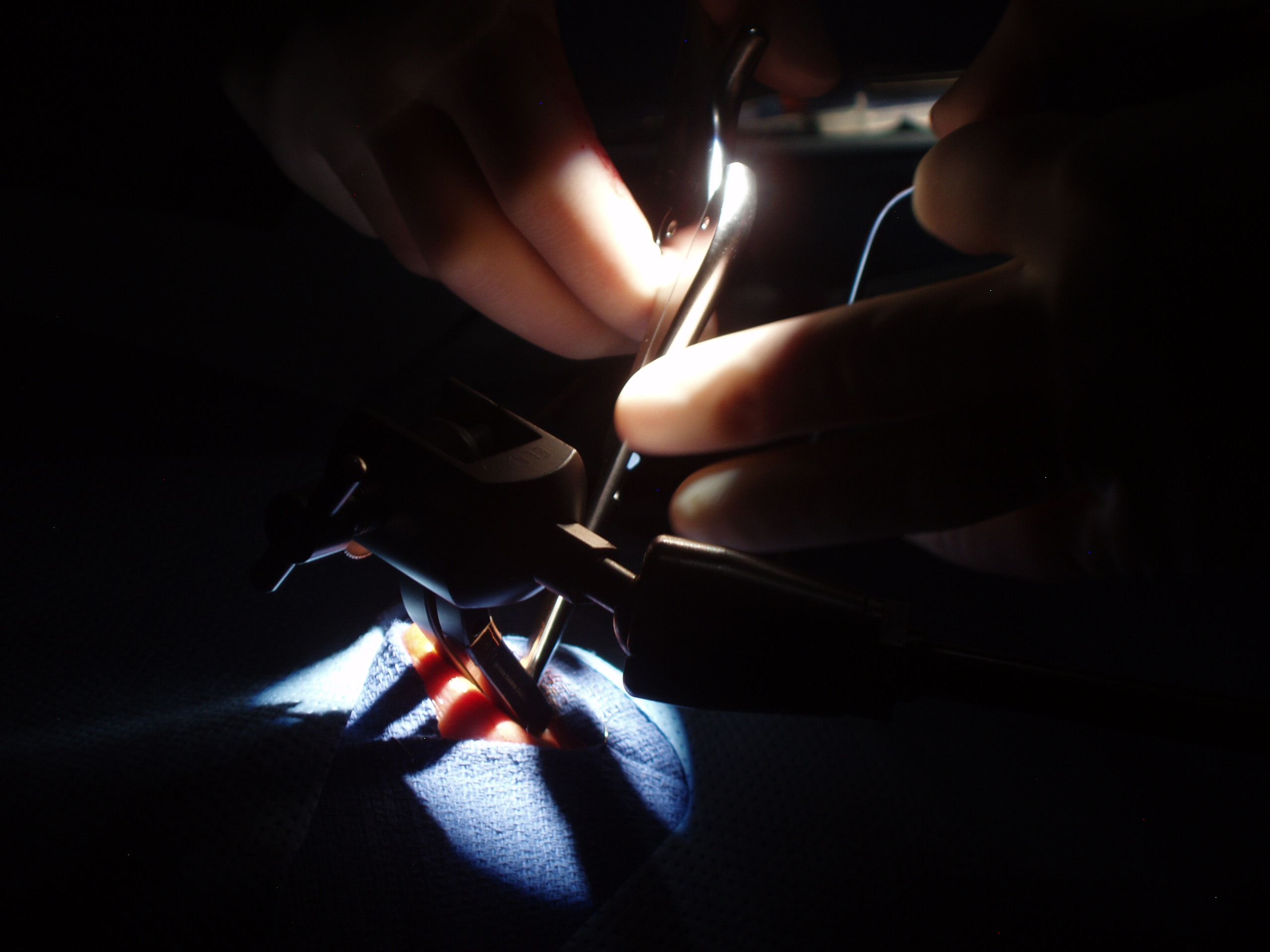 Transnasal Surgery