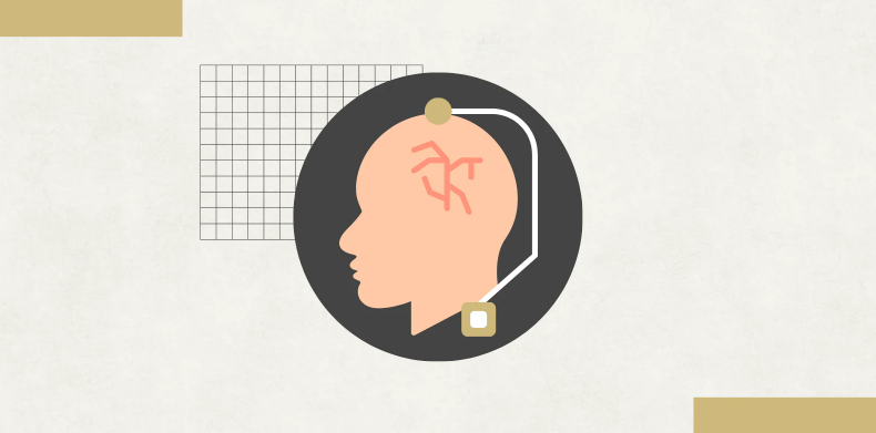 Illustration showing deep brain stimulation