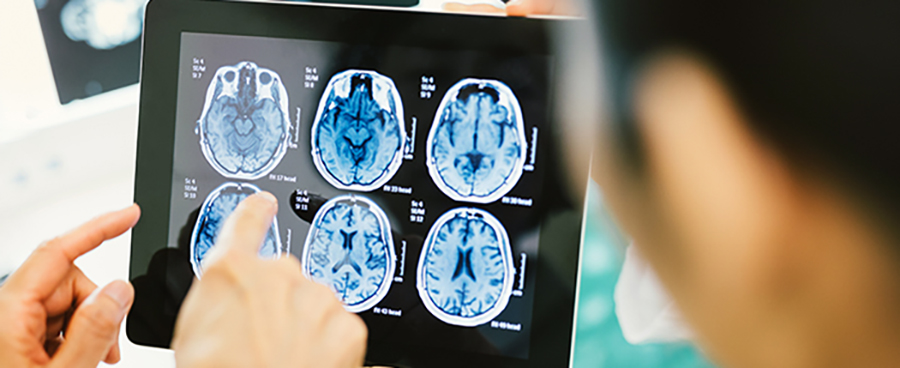health care workers looking at brain scans
