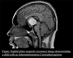 MRI Figure  ns hankinson
