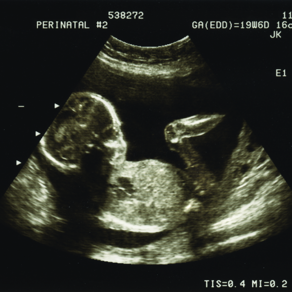 cu-obgyn-mfm-fellowship-card