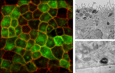 Human Retinal Pigment Epithelium monolayers