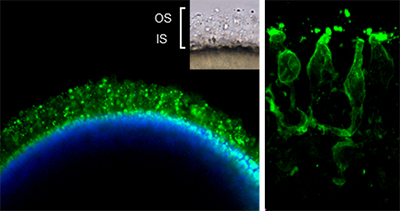 Human Retinal Organoids