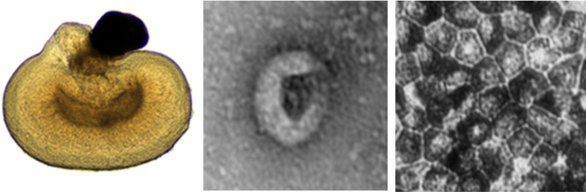 Human RPE secreted exosomes