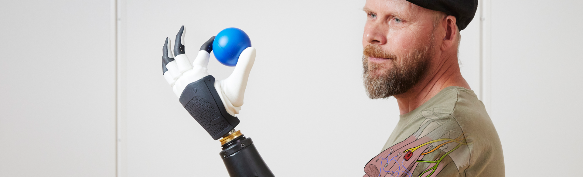 New Faculty Member in Department of Orthopedics Brings Expertise in Prosthetic Limb Technology