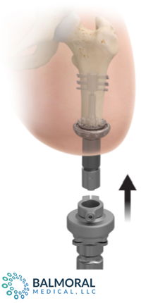Transdermal Compress Device