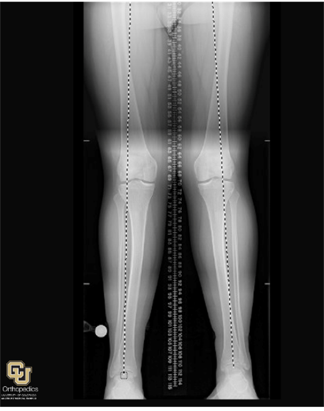 Congenital Conditions