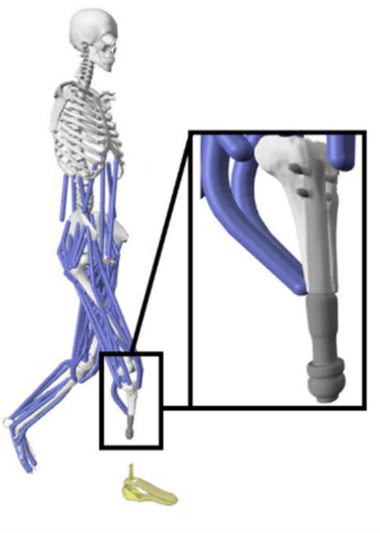 Stiffness of a Prosthetic Foot