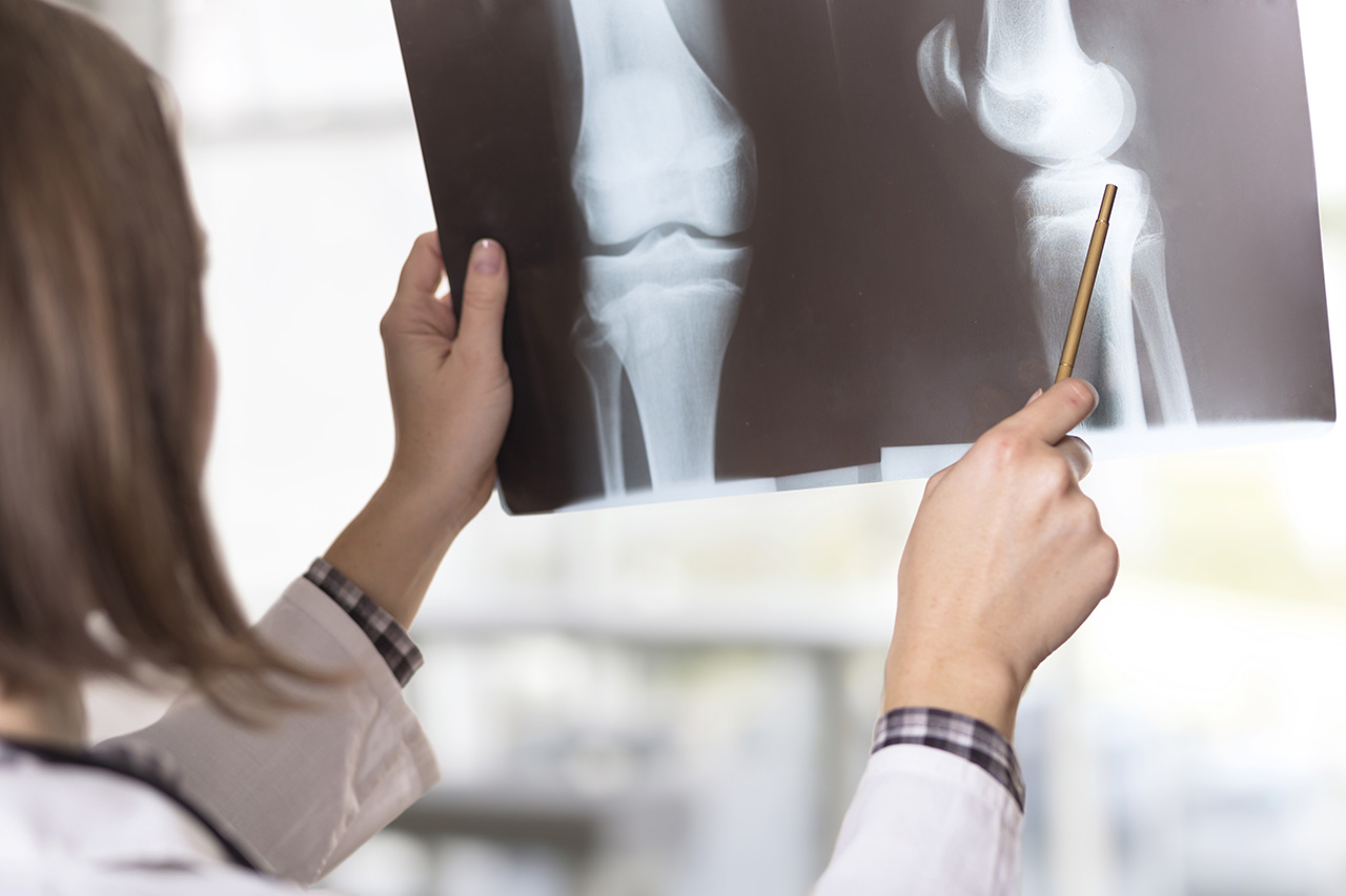 Doctor Viewing Xray
