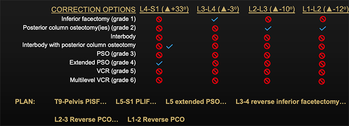 Complex UNiDTM ASI T10-Pelvis correction