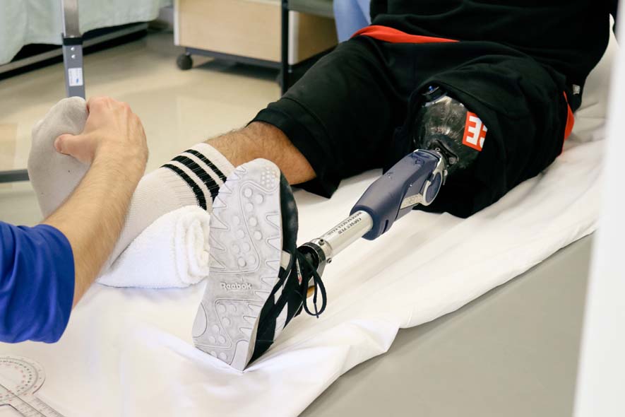 University Colorado Osseointegration Prosthetic Stoneback