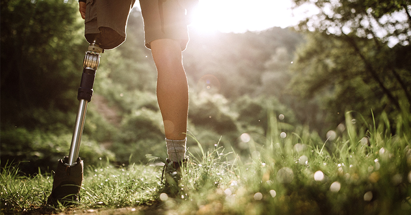 Novel Mobility Survey Taps Prosthesis Users