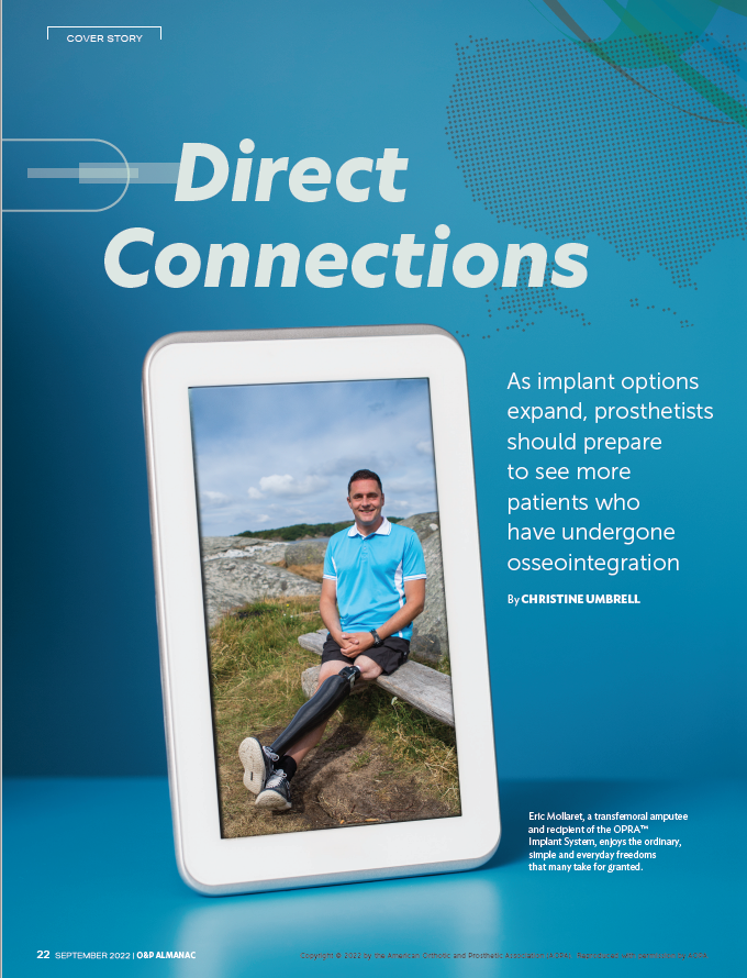 Osseointegration Direct Connections