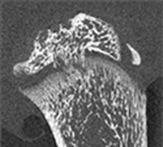 Animal models of growth plate injury