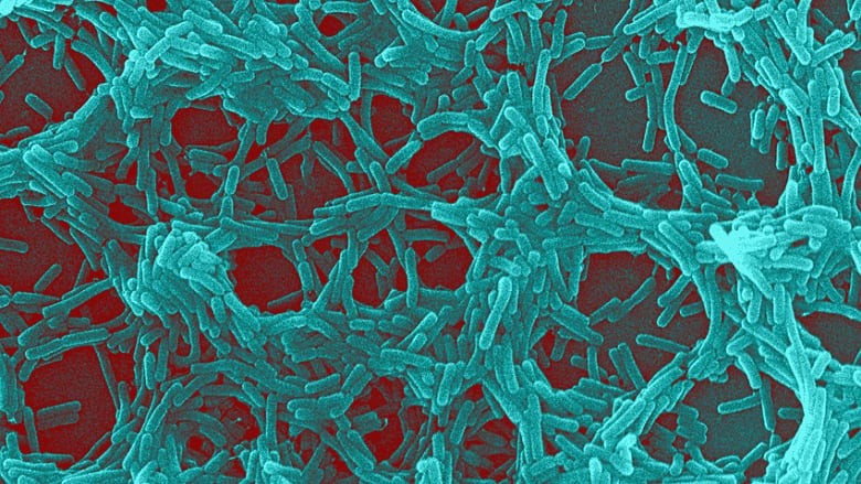 Your microbiome may be giving you arthritis. How can we understand it better? | CBC Radio