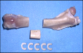 Identifying genes that regulate bone strength and matrix quality