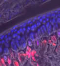 Articular response to altered joint loading