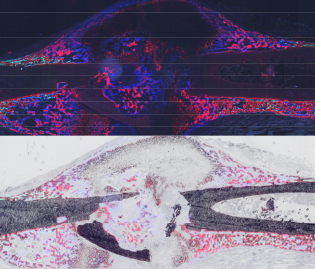 Molecular & Cellular Biology of Fracture Repair