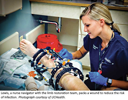 UCHEALTH’S LIMB RESTORATION PROGRAM: RETURNING PATIENTS TO THEIR OPTIMAL SELF