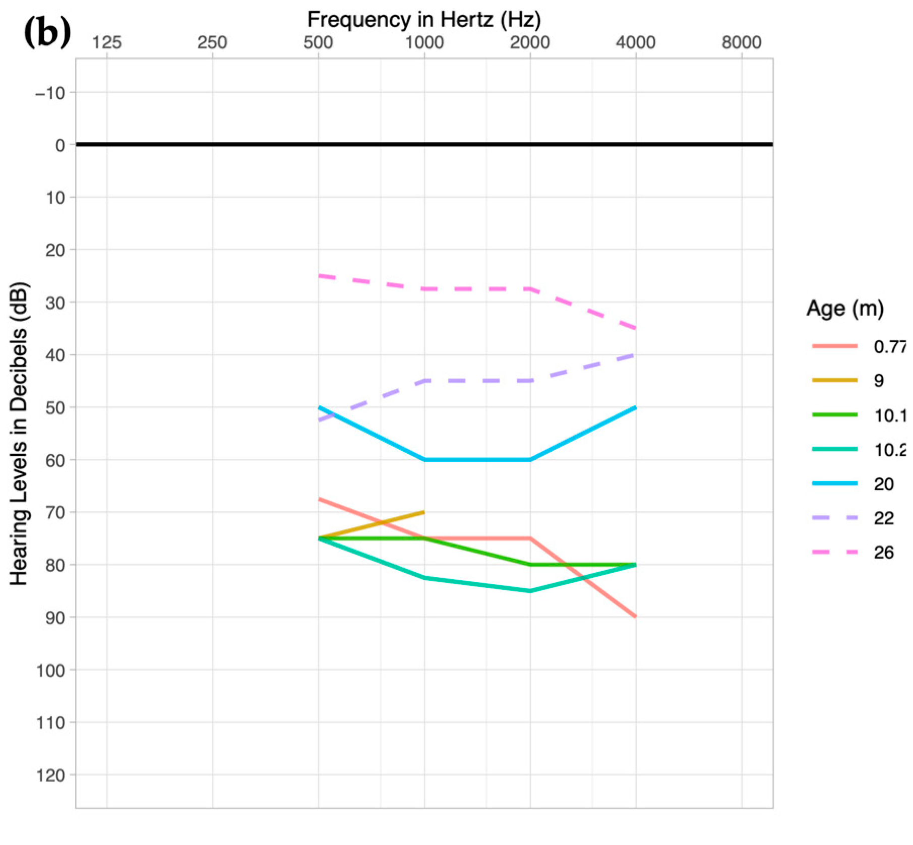 Hearing loss graph