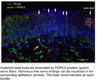 Marie Jette Research Picture 1