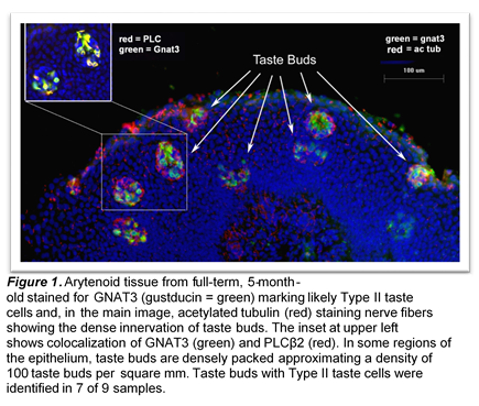 Marie Jette Research Picture 2
