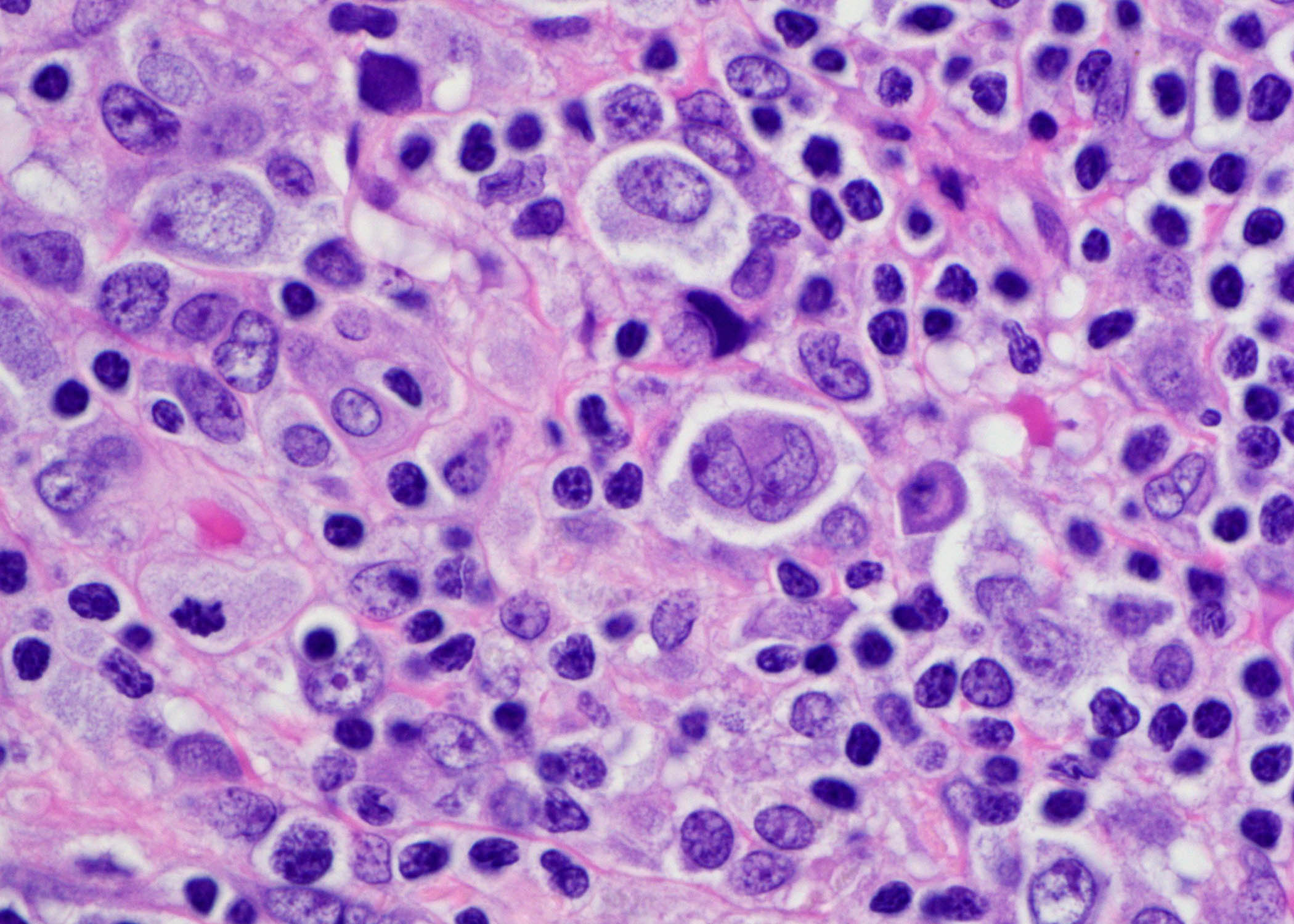 Anatomic PathologyThumbnail_Sized2