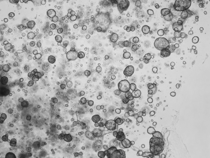 Human Pancreas