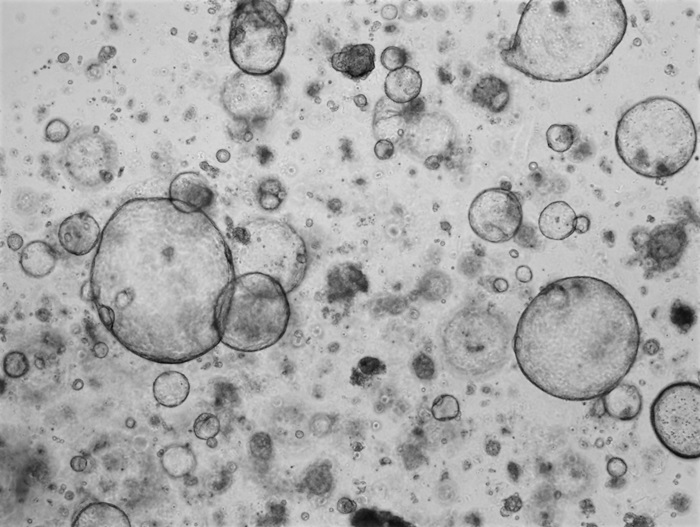 Human Pancreas_2