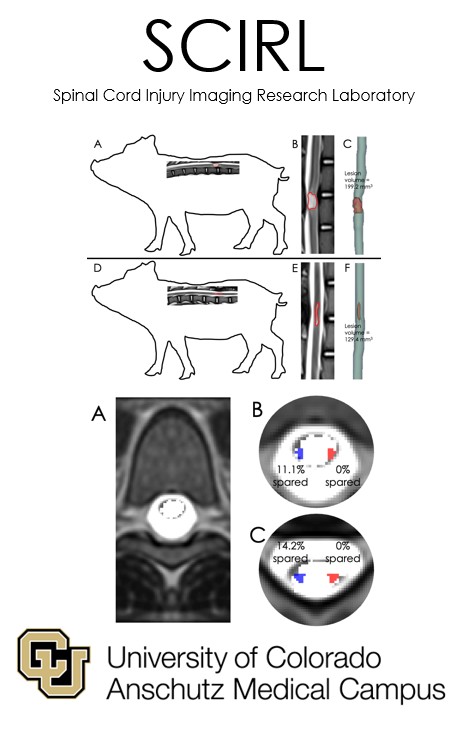 Spinal Cord Injury Imaging Research Lab